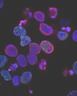 AI in Diagnostics and Point-of-Care Testing: Healthcare AI Survey